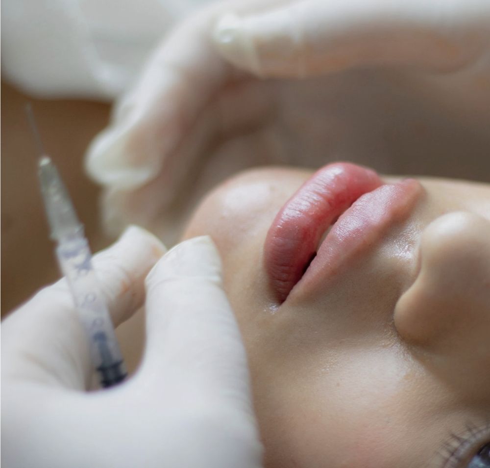Close-up of a lip treatment performed by Divine Beauty Company